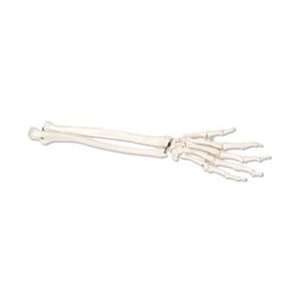  Loose Hand Skeleton with Portions of Ulna and Radius 