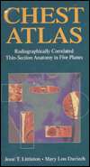 Chest Atlas Radiographically Correlated Thin Section Anatomy in Five 