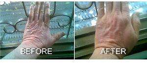 100% NATURAL HERBAL CREAM FOR PSORIASIS, 2 x 20 g.  