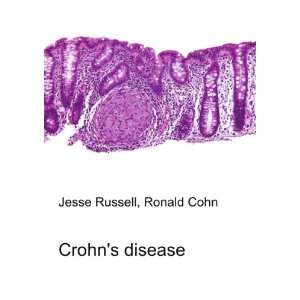  Crohns disease Ronald Cohn Jesse Russell Books