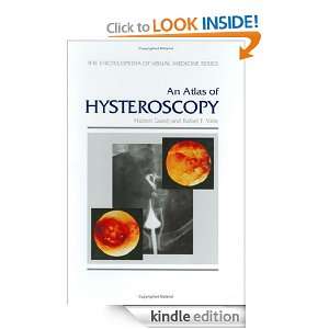 An Atlas of Hysteroscopy (Encyclopedia of Visual Medicine Series) H 