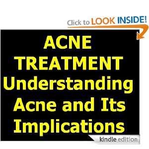 Acne Treatment   Understanding Acne and Its Implications Jeoff 